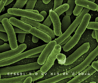 Escherichia coli aus der Gattung Enterobacter